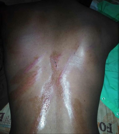Students brutalized in school for being Marlians